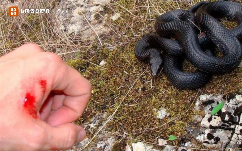 როგორ უნდა მოვიქცეთ გველის ნაკბენისას – პირველი სამედიცინო დახმარება გველის ნაკბენის დროს