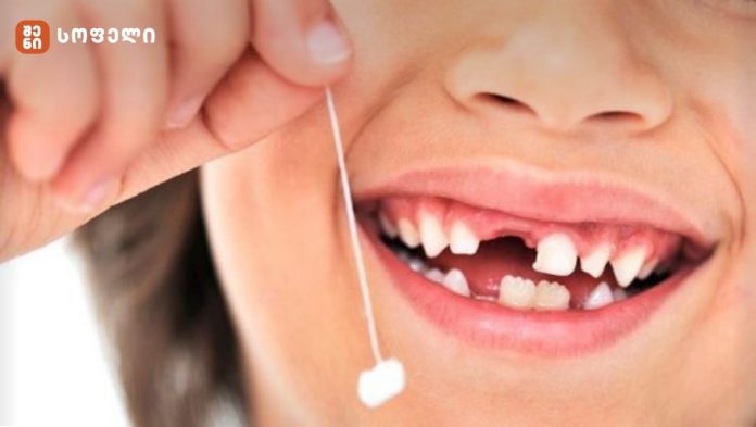 არ გადააგდოთ ბავშვის სარძევე კბილი! – მეცნიერების ახალი აღმოჩენა სარძევე კბილთან დაკავშირებით